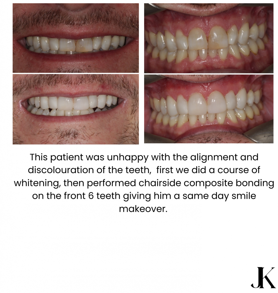 Jonidas Photo Book Booklet Small 1