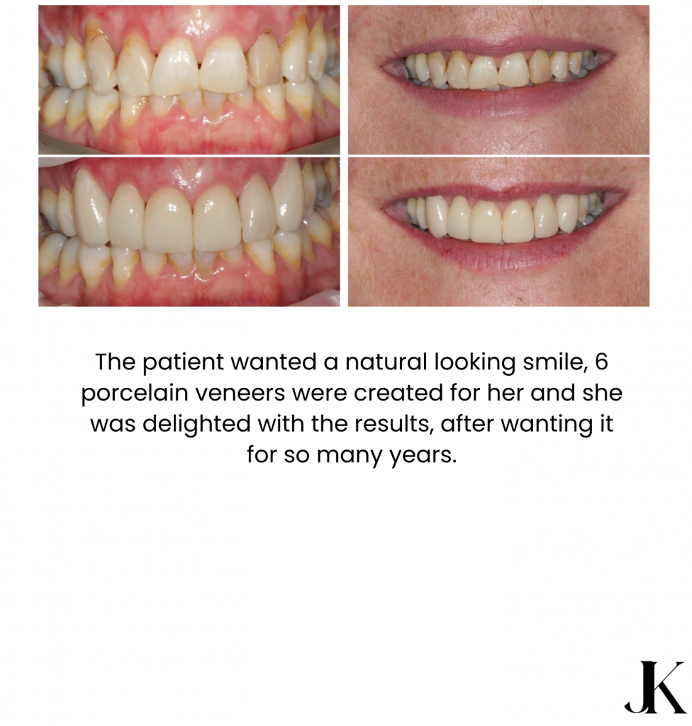 Jonidas Photo Book Booklet Small 3